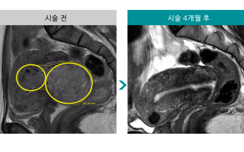 48세색전술.jpg