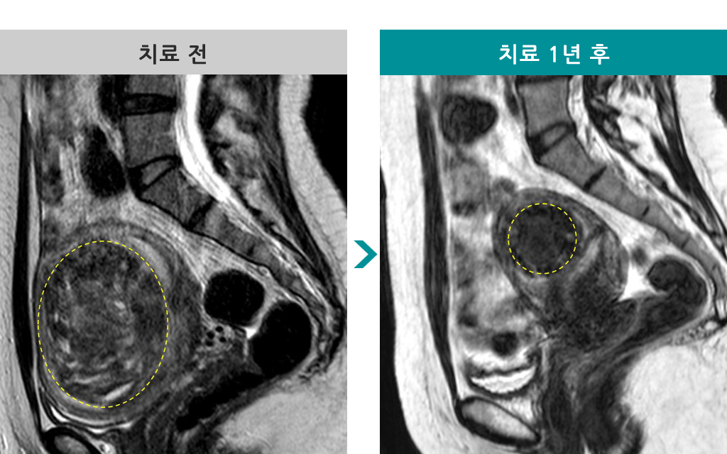 00832449하이푸41세.jpg